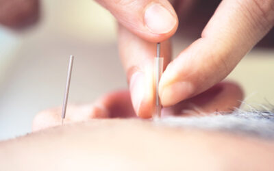 Why You Should NOT Use A Chiropractor for Acupuncture