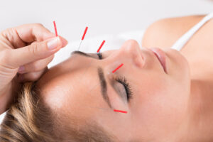 Acupuncture Daphne AL, acupuncture brentwood, acupuncture Daphne, SAAT acupuncture brentwood, SAAT acupuncture Daphne, SAAT Acupuncture Daphne AL, alpha gal Acupuncture Daphne ALpha gal acupuncture brentwood