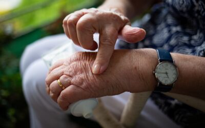Acupuncture and Functional Medicine for Rheumatoid Arthritis